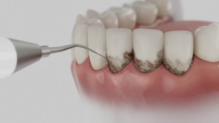 Reliable Dental Implants contractor in Ralston, NE by Smile Center Dentistry